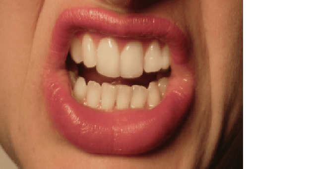 BIBIR DARI WAJAH MARAH